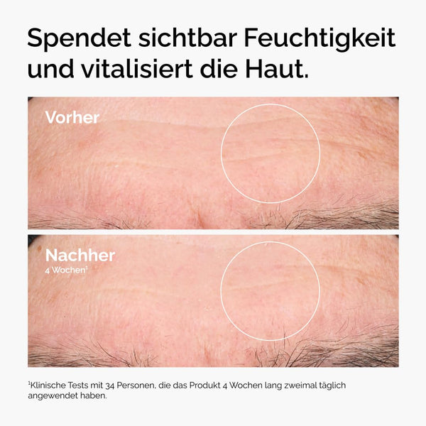 The Ordinary Hyaluronic Acid 2% + B5 (with Ceramides), Hyaluronsäure + B5 (mit Ceramiden), Tiefenwirksames Hydrationsserum für vitalere, glattere Haut, 30ml